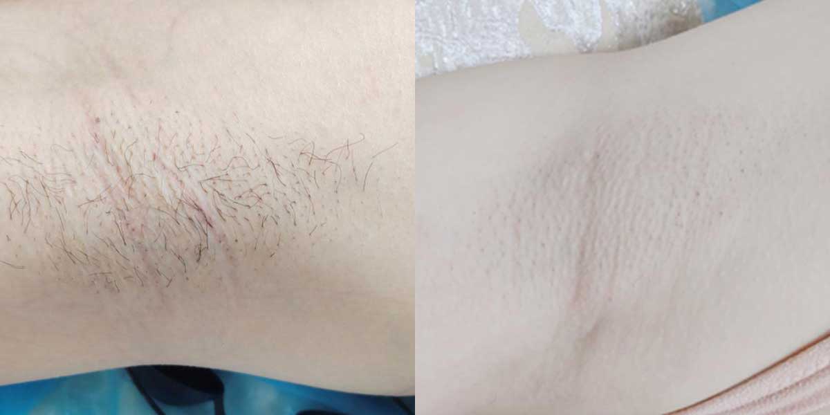 before-after-03